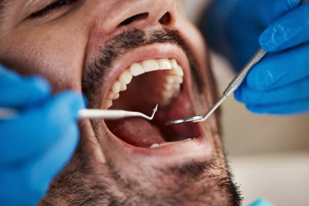 Best Emergency Treatment for Oral Infections in Rogersville, MO